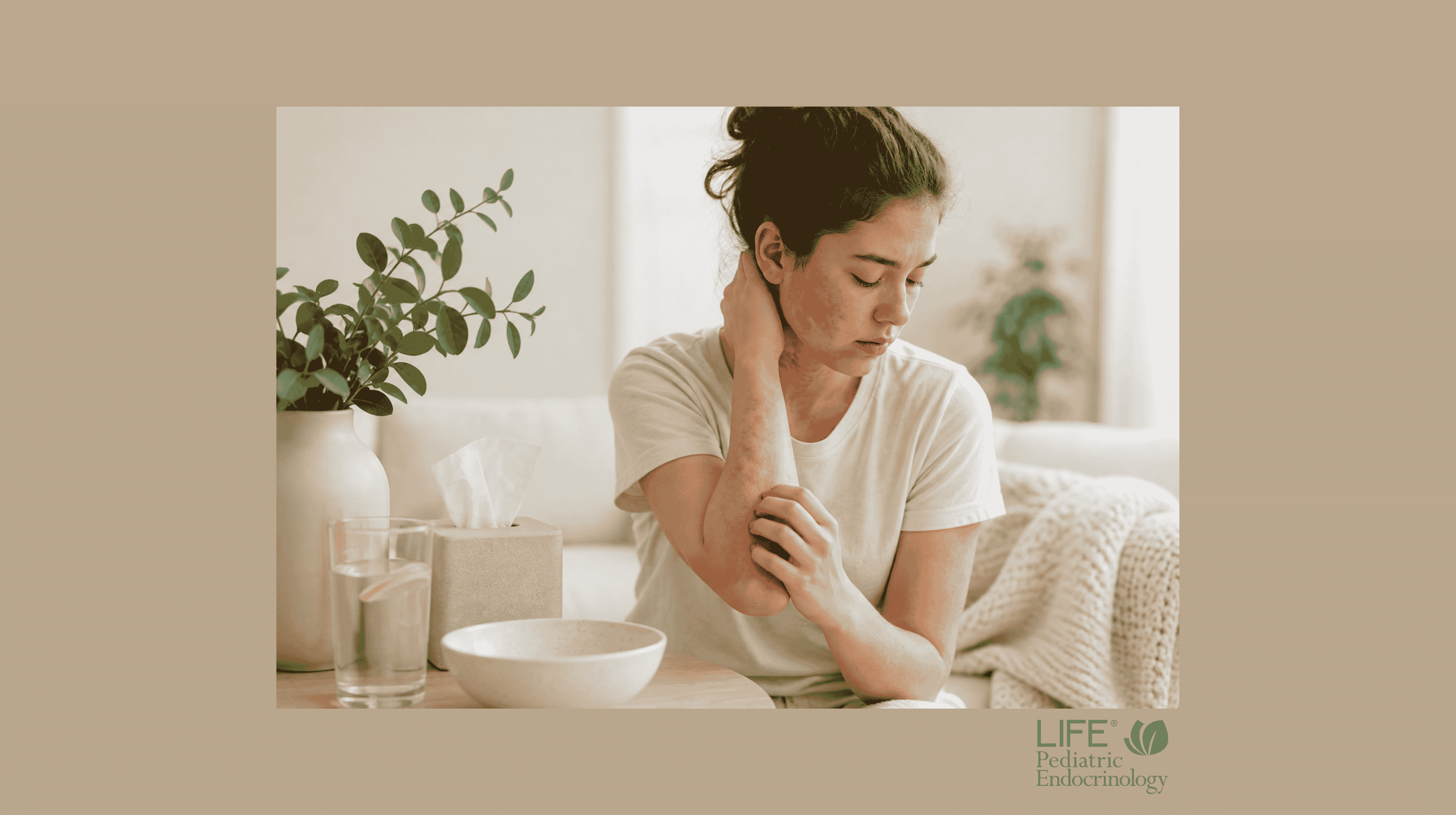 Teen girl with red, irritated skin on her face, neck and arm, representing flushing, rash and itching associated with mast cell activation syndrome (MCAS) in adolescents.