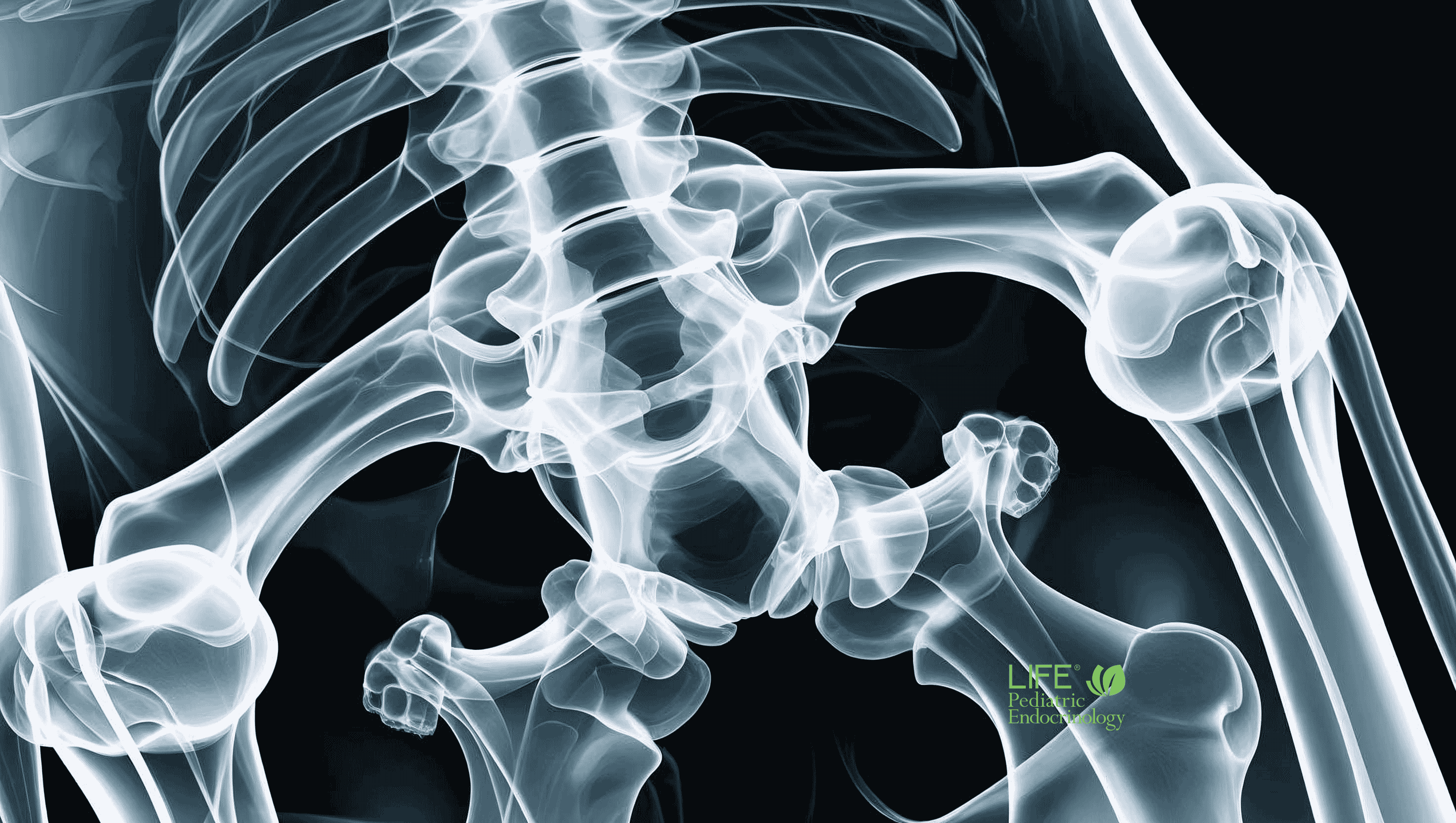 symptoms-of-bone-disease-child-xray